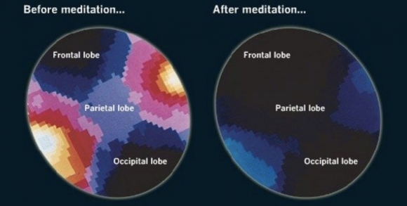 How to make meditation work for you