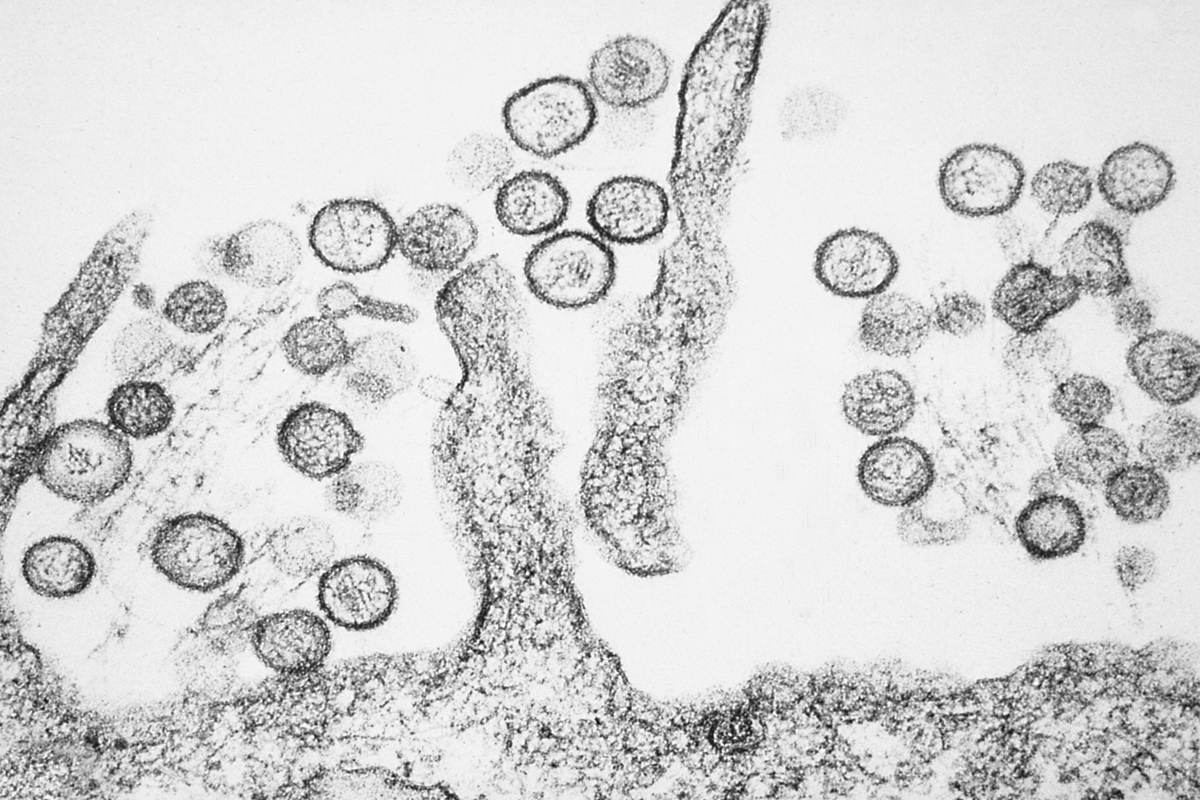Why Hantavirus outbreak deserves our attention